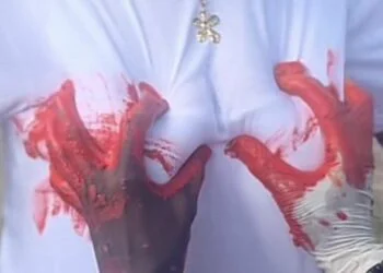 Haiti: “Handprint art” at the center of a controversy over consent