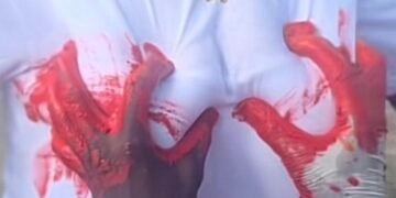 Haiti: “Handprint art” at the center of a controversy over consent